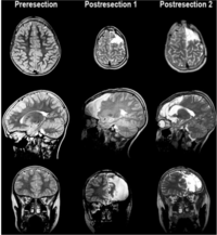 Brainsci 03 01597 g001 200