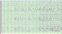 Brainsci 03 01597 g004 200