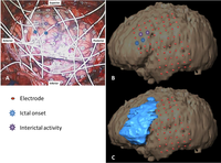 Brainsci 03 01597 g005 200