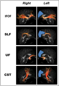 Brainsci 03 01597 g006 200