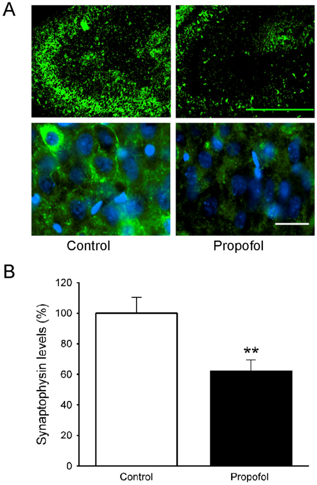 Brainsci 04 00356 g005 1024