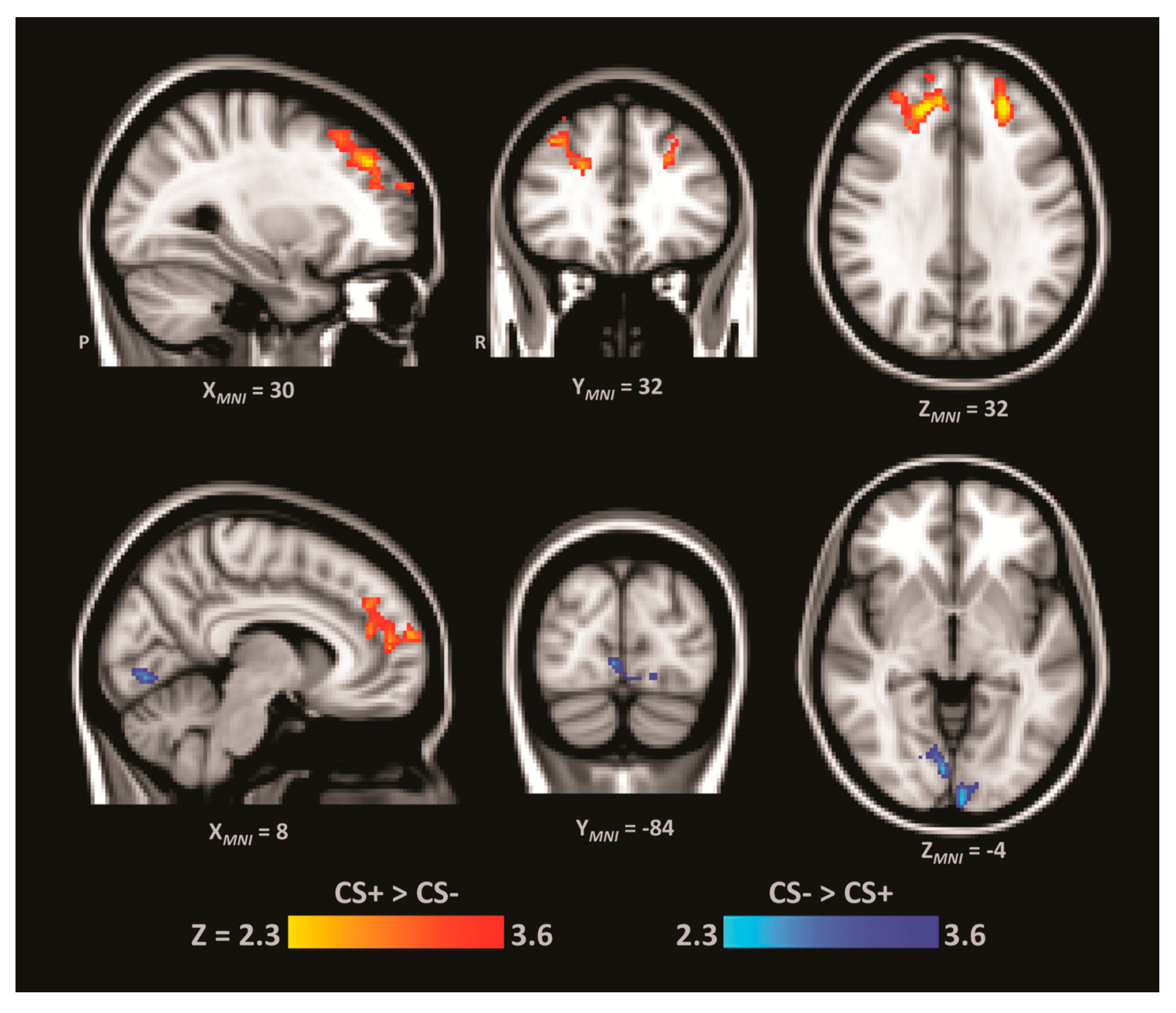 brain sciences free full text individual differences in which letter indicates the primary somatosensory cortex