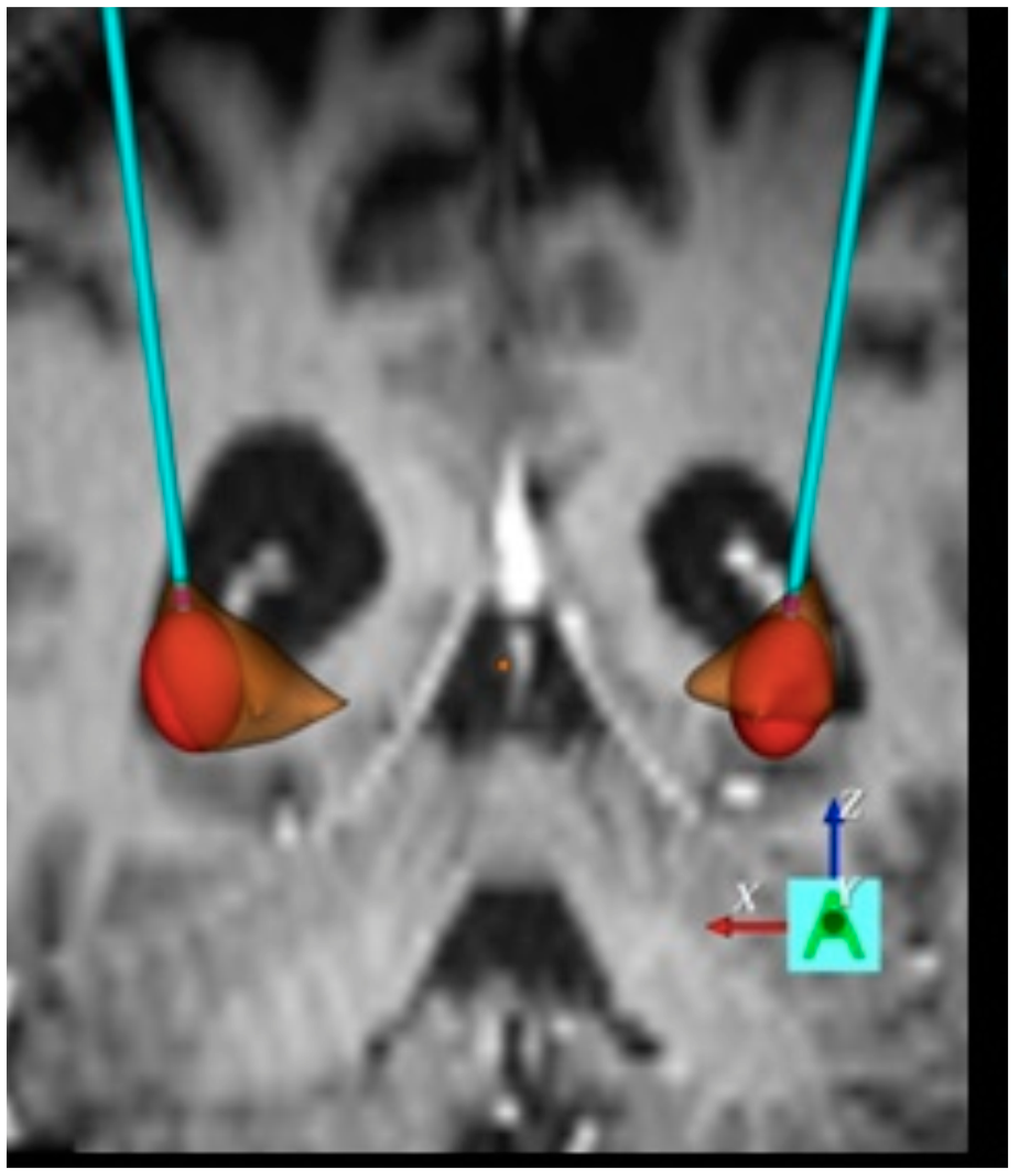 Brainsci 06 00038 g003