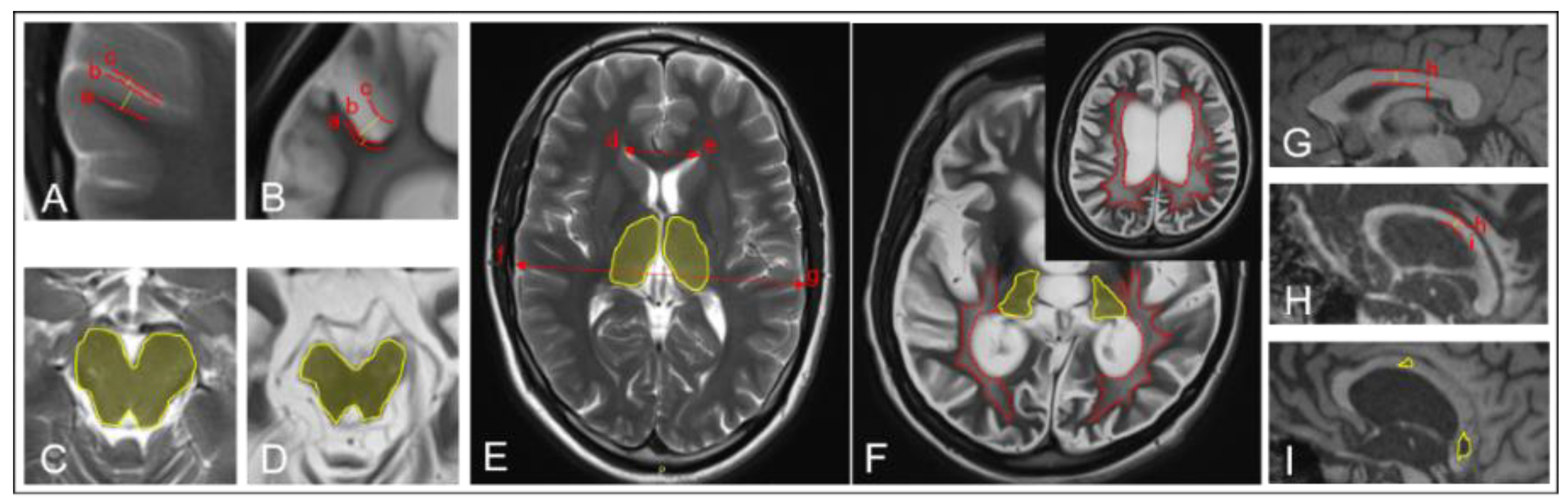 Brainsci 08 00144 g001