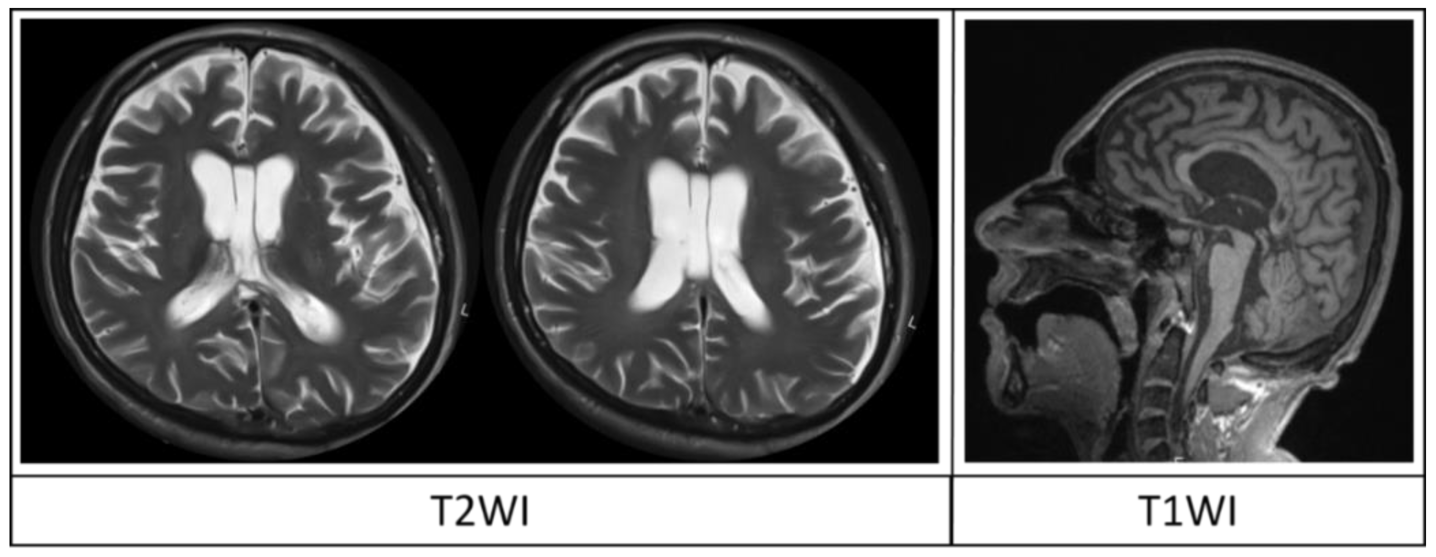 Brainsci 08 00144 g002