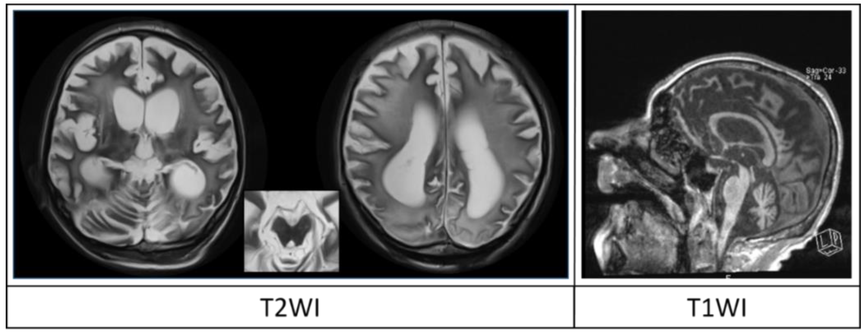 Brainsci 08 00144 g003