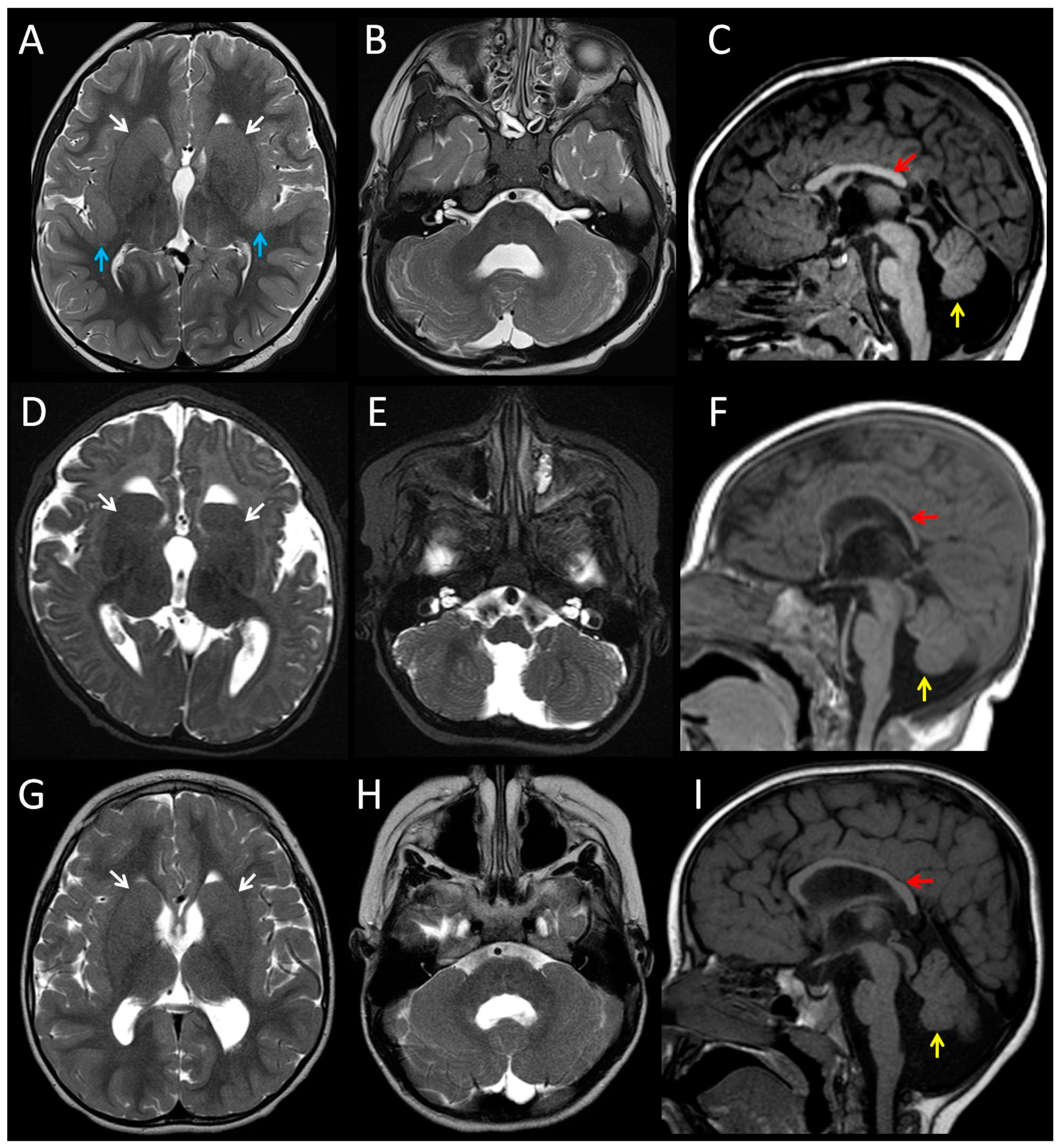 Brainsci 08 00145 g001