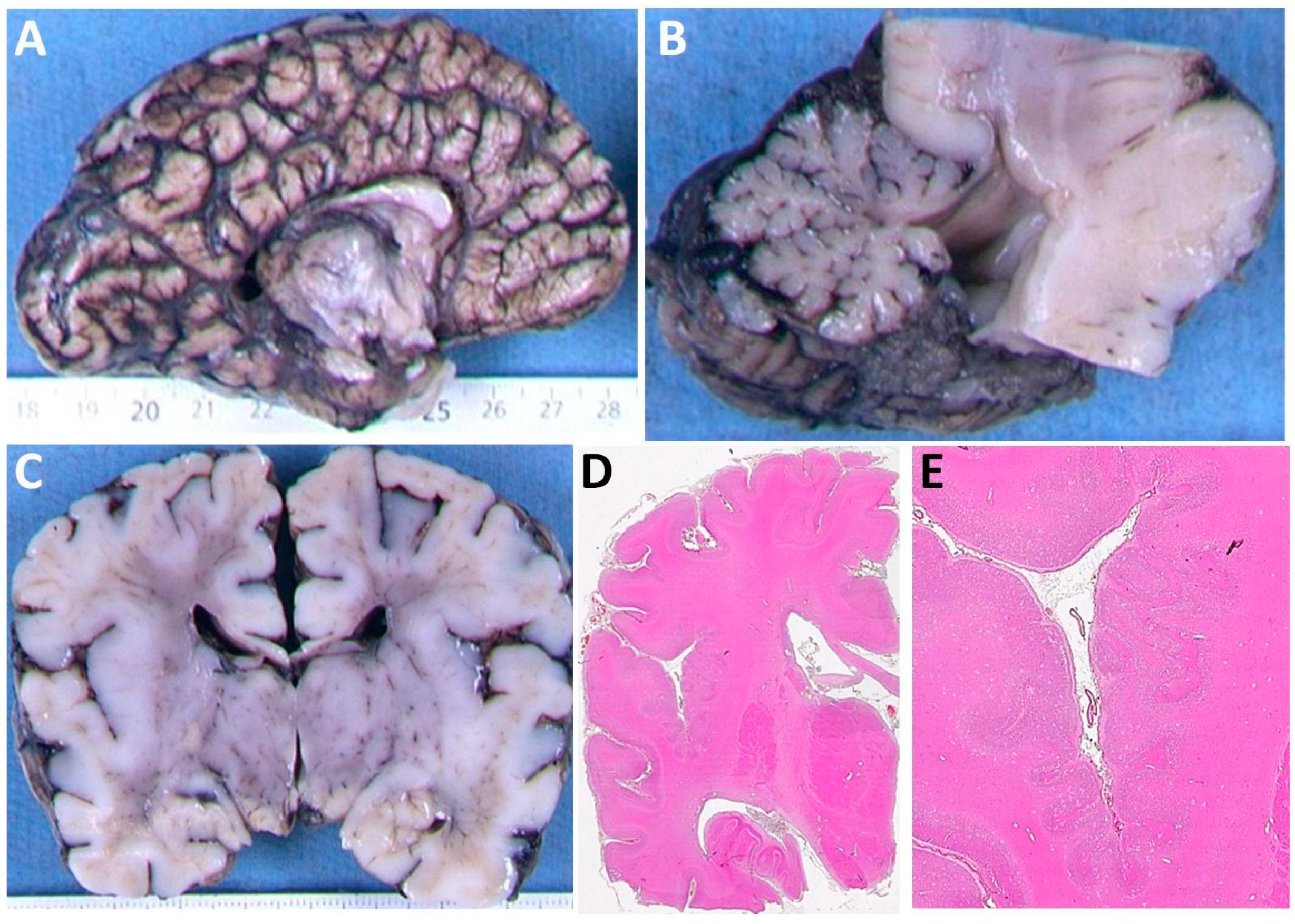 Brainsci 08 00145 g002