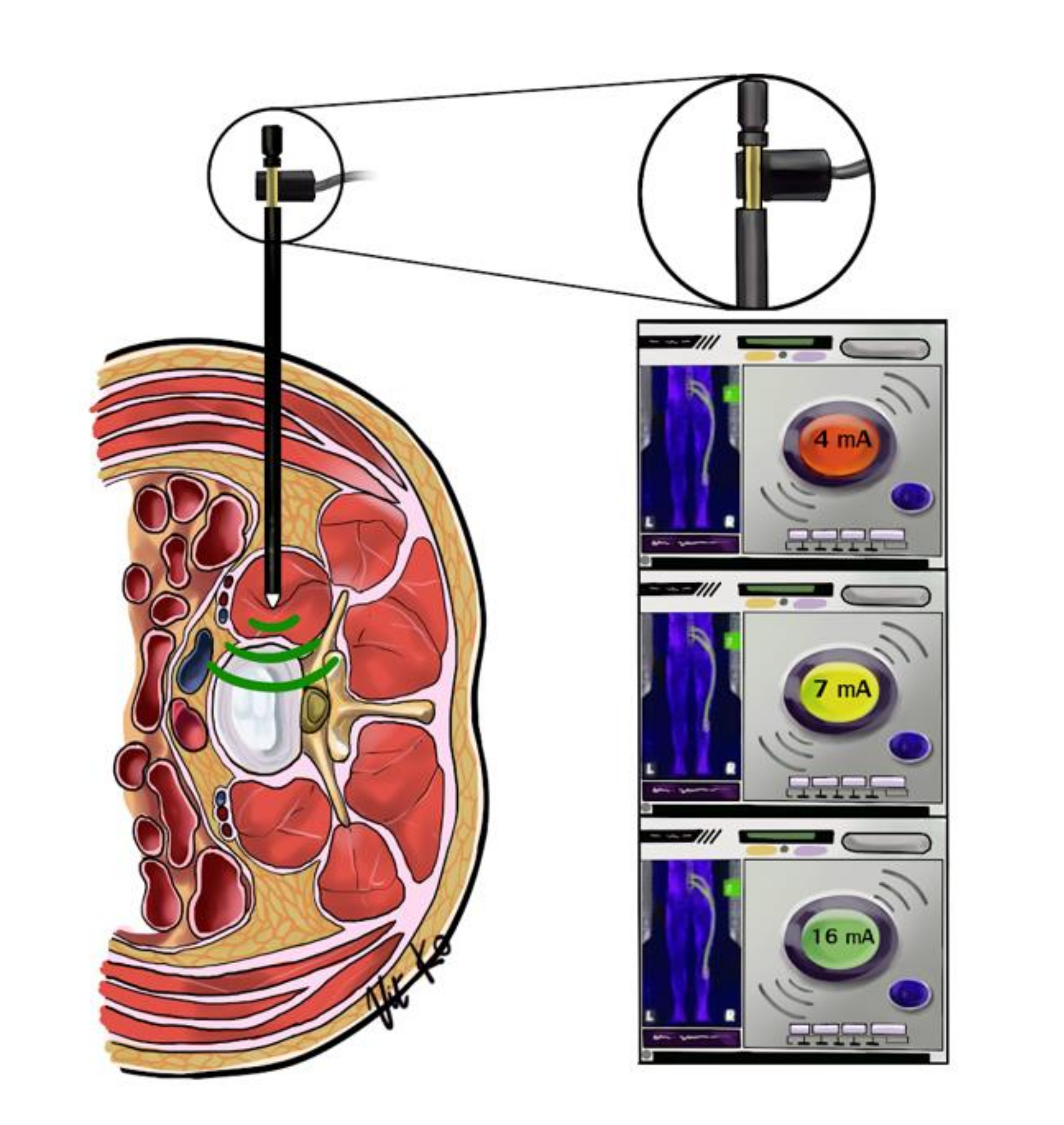 Brainsci 11 00357 g002 Brainsci 11 00357 g002
