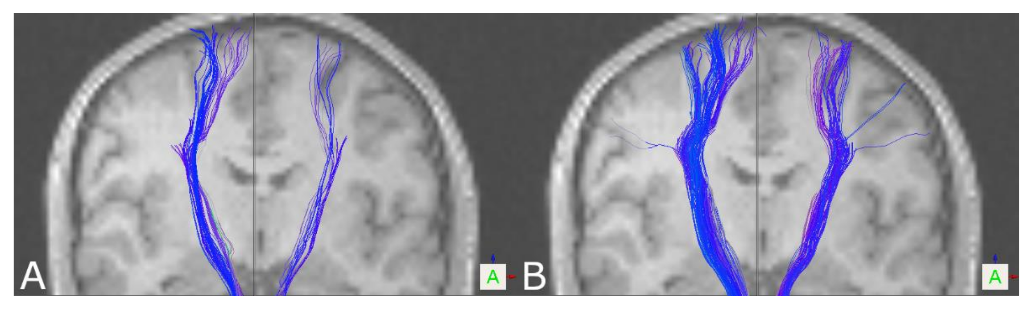 Brainsci 11 00381 g001 Brainsci 11 00381 g001