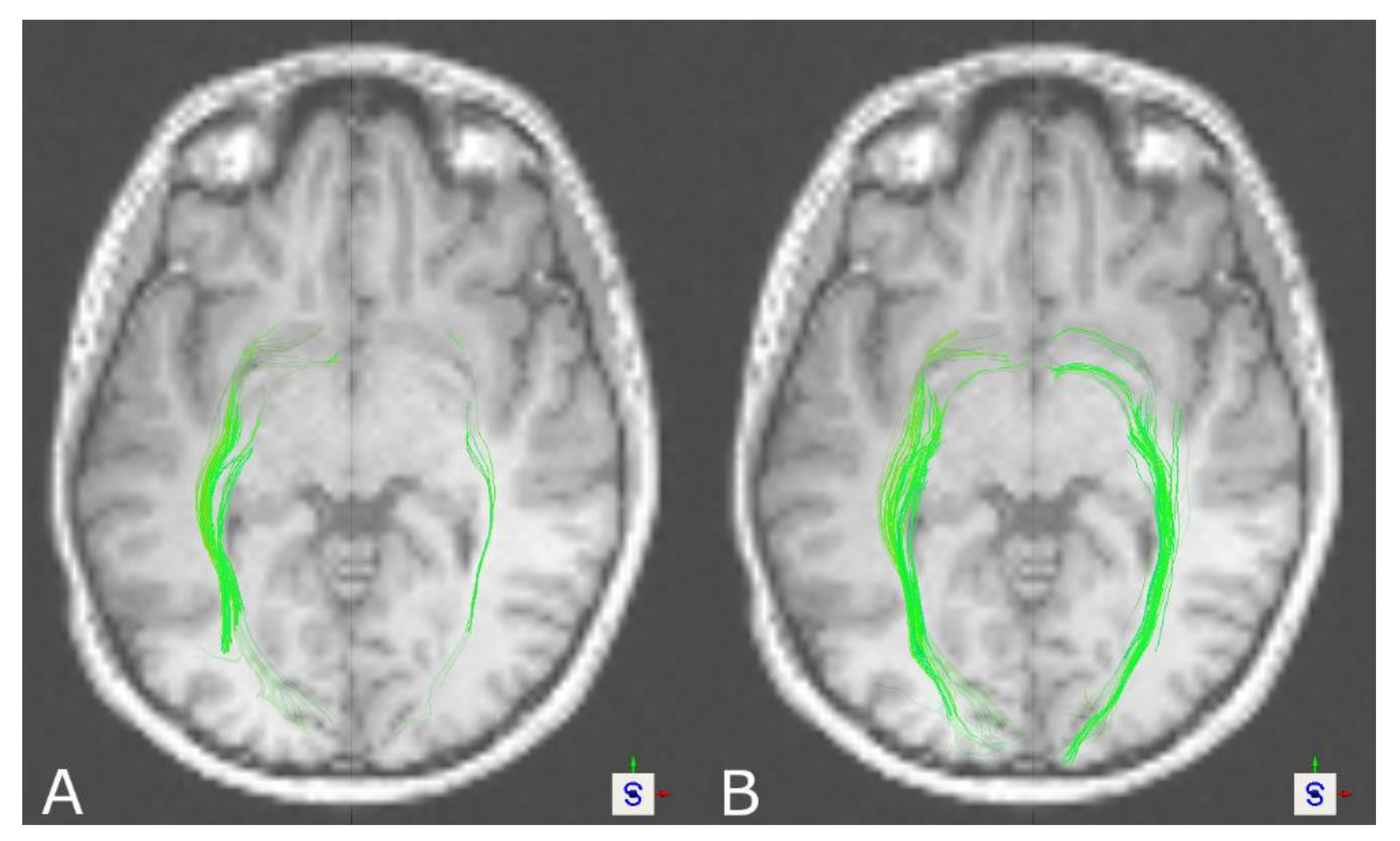 Brainsci 11 00381 g003 Brainsci 11 00381 g003