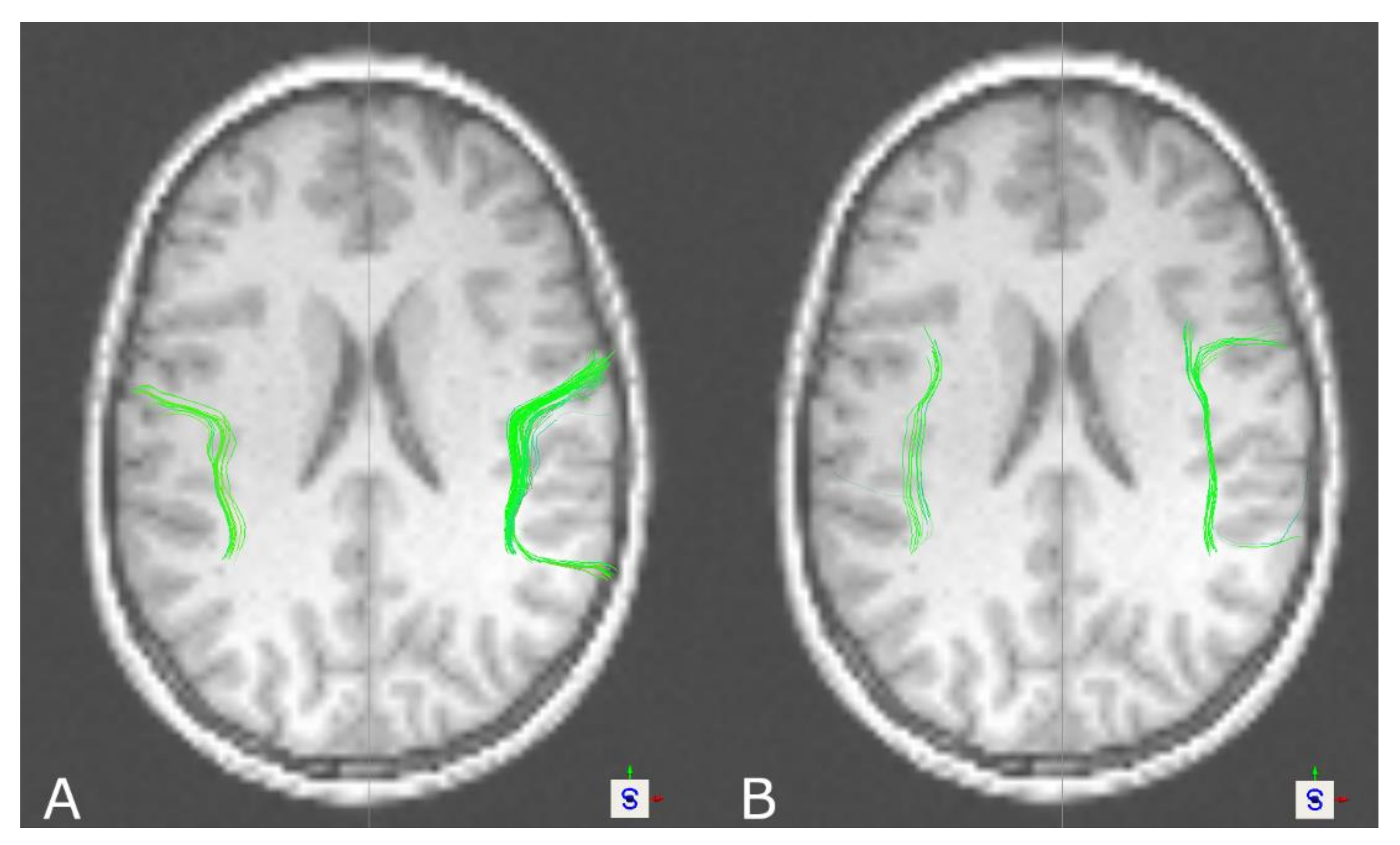 Brainsci 11 00381 g004 Brainsci 11 00381 g004