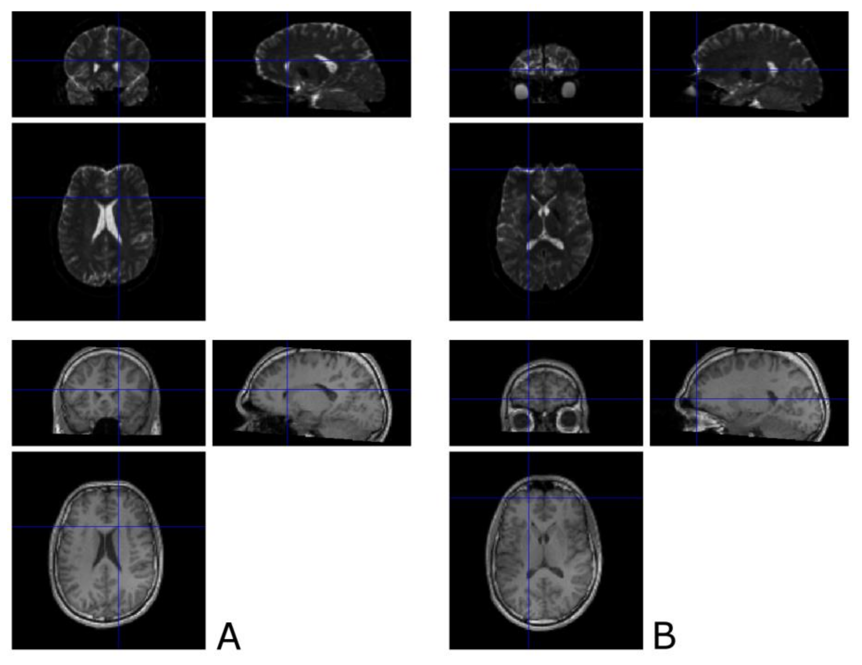 Brainsci 11 00381 g0a1 Brainsci 11 00381 g0a1