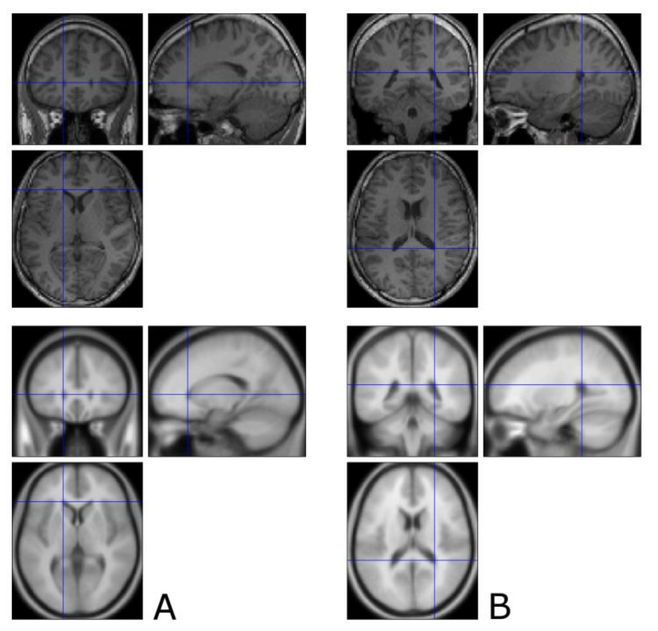 Brainsci 11 00381 g0a2 Brainsci 11 00381 g0a2