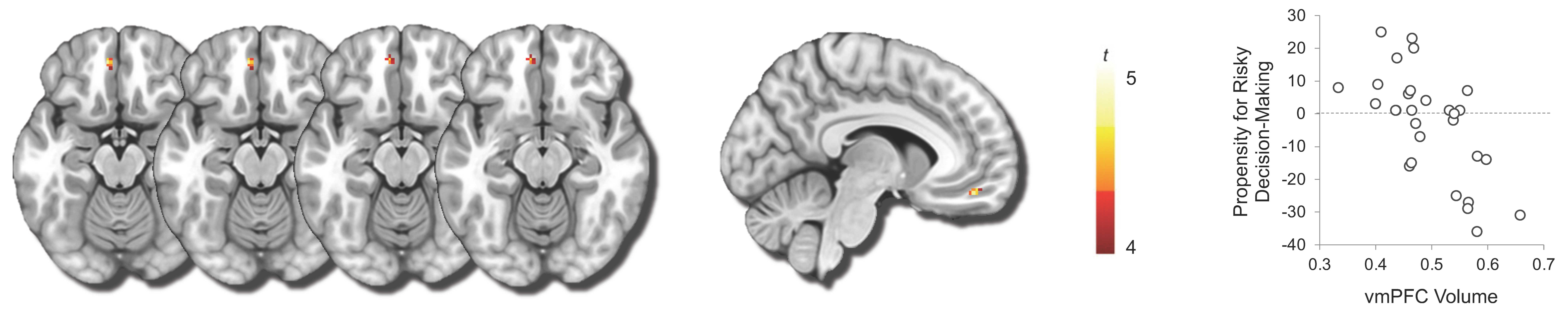 Brainsci 12 01460 g003 Brainsci 12 01460 g003
