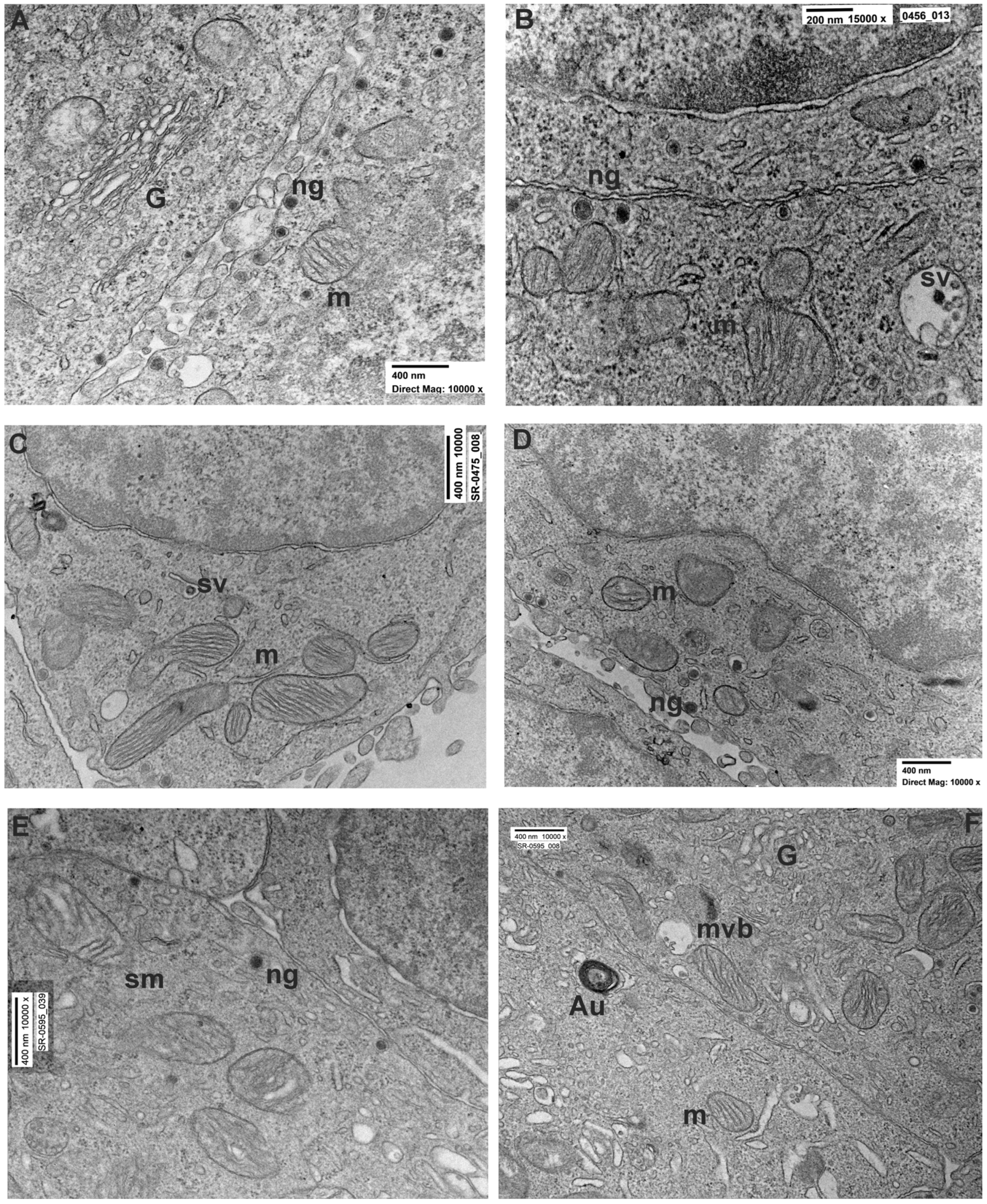 Brainsci 14 00476 g002