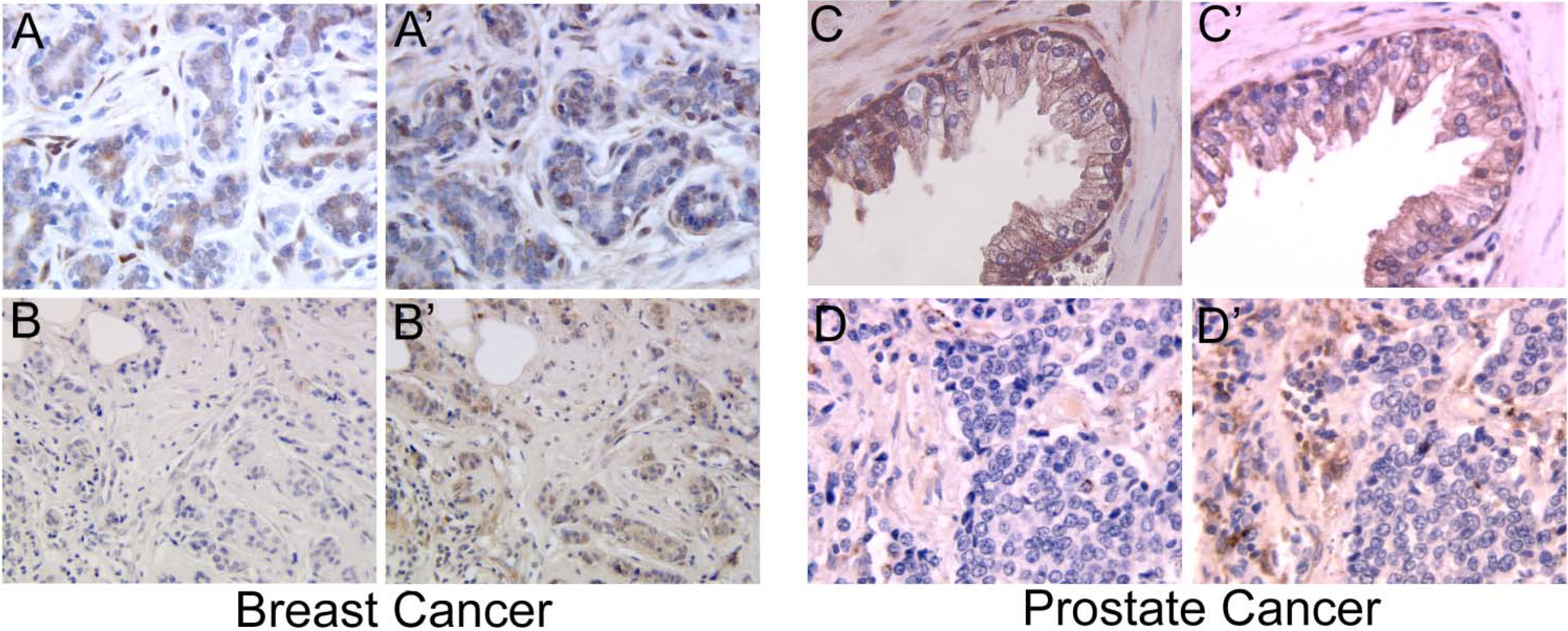 Cancers 02 00592 g001
