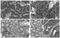 Cancers 03 01372f2 200