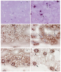 Cancers 03 01372f4 200