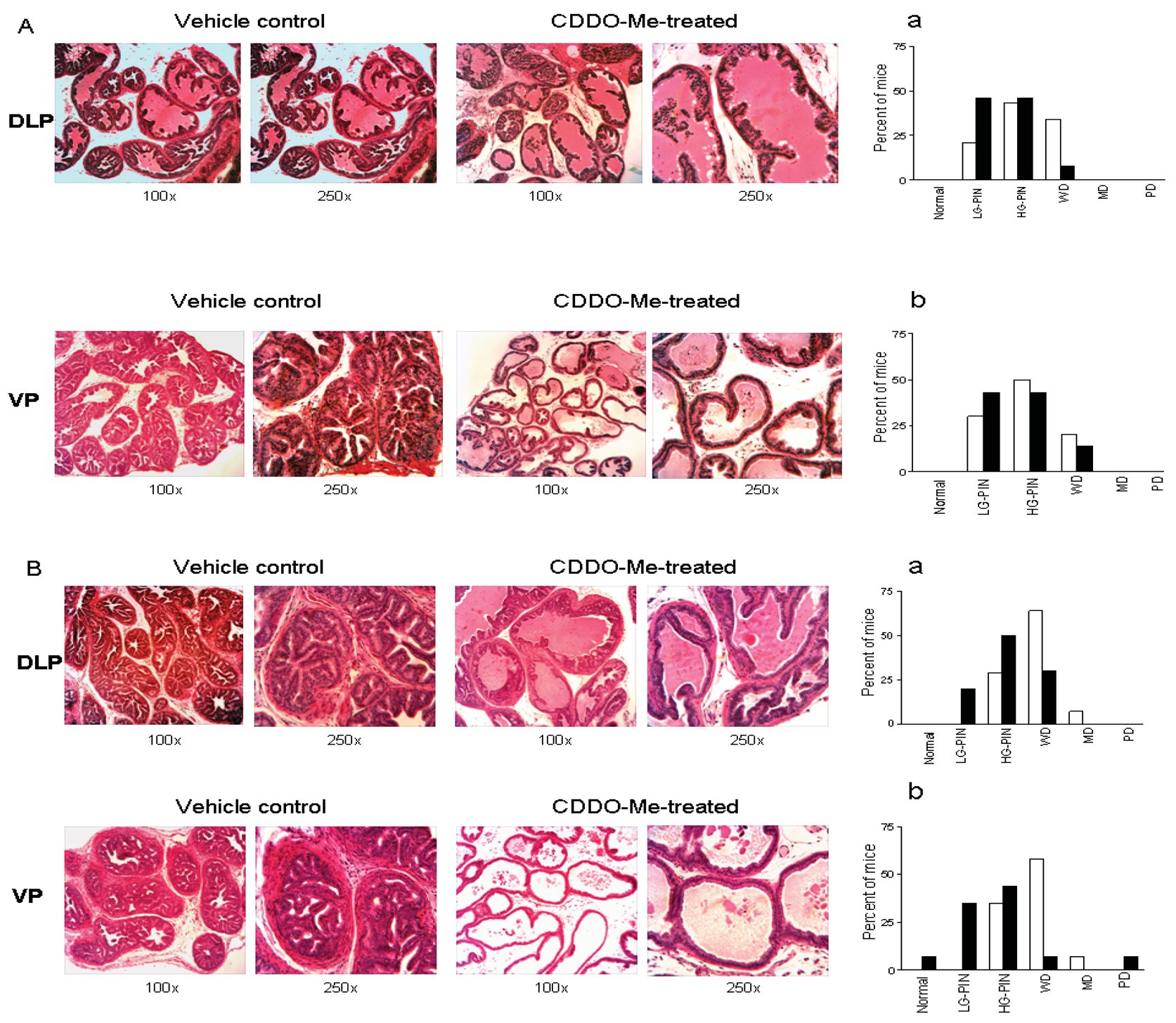 Cancers Free FullText Prevention of Prostate Cancer with Oleanane