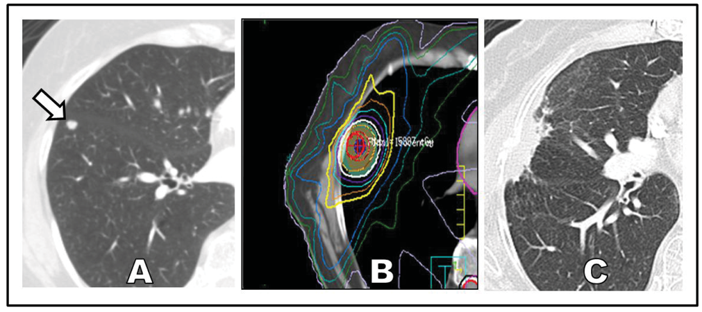 Cancers 03 03432f1 1024
