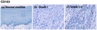 Cancers 03 03726f3a 200
