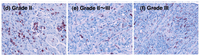 Cancers 03 03726f3b 200