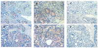 Cancers 03 03824f4a 200
