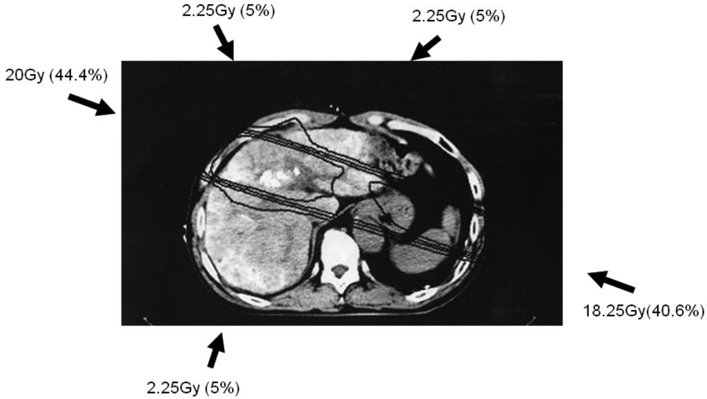 Cancers 03 04114f1 1024