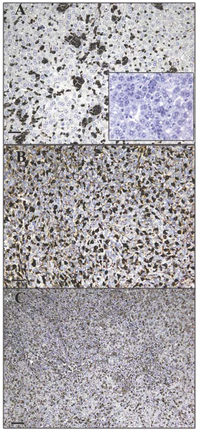 Cancers 03 04151f1 200