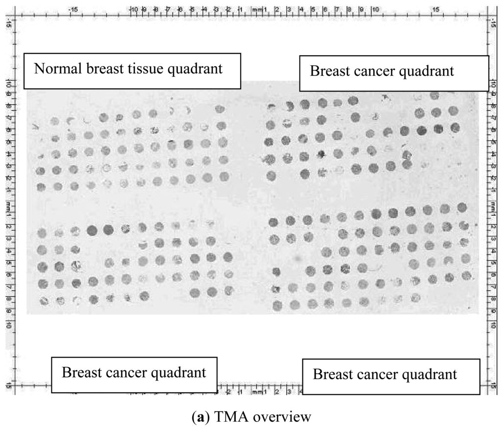 Cancers 03 04212f1a 1024