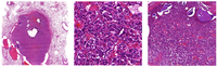 Cancers 04 00777 g007 200