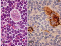 Cancers 05 00714 g001 200
