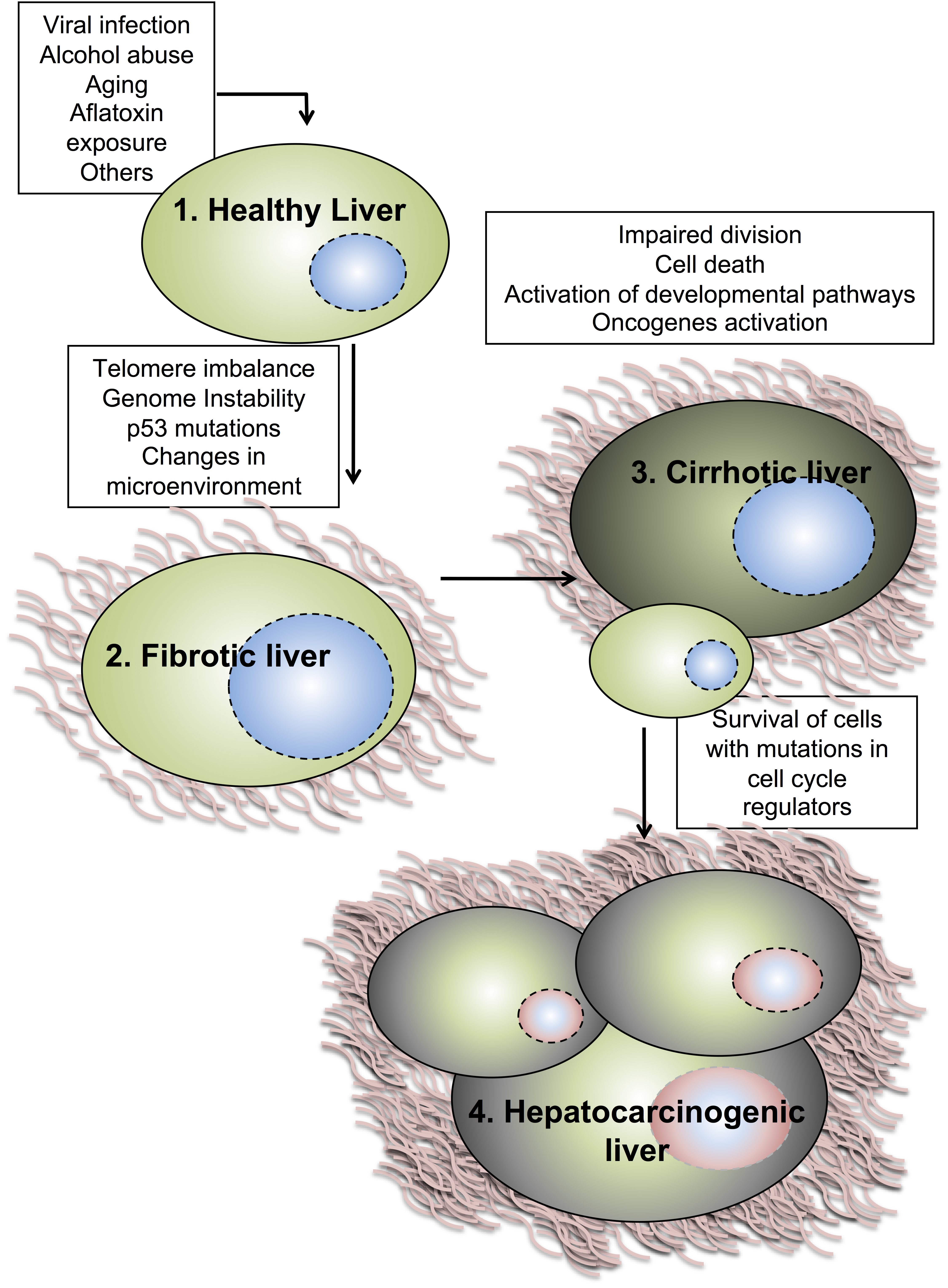 Diagram Of Liver Cancer Choice Image - How To Guide And 