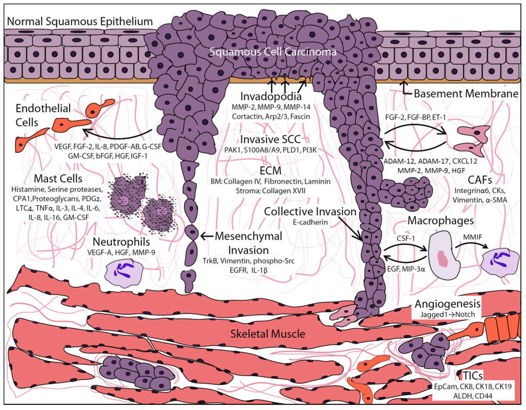 scc cancers #10