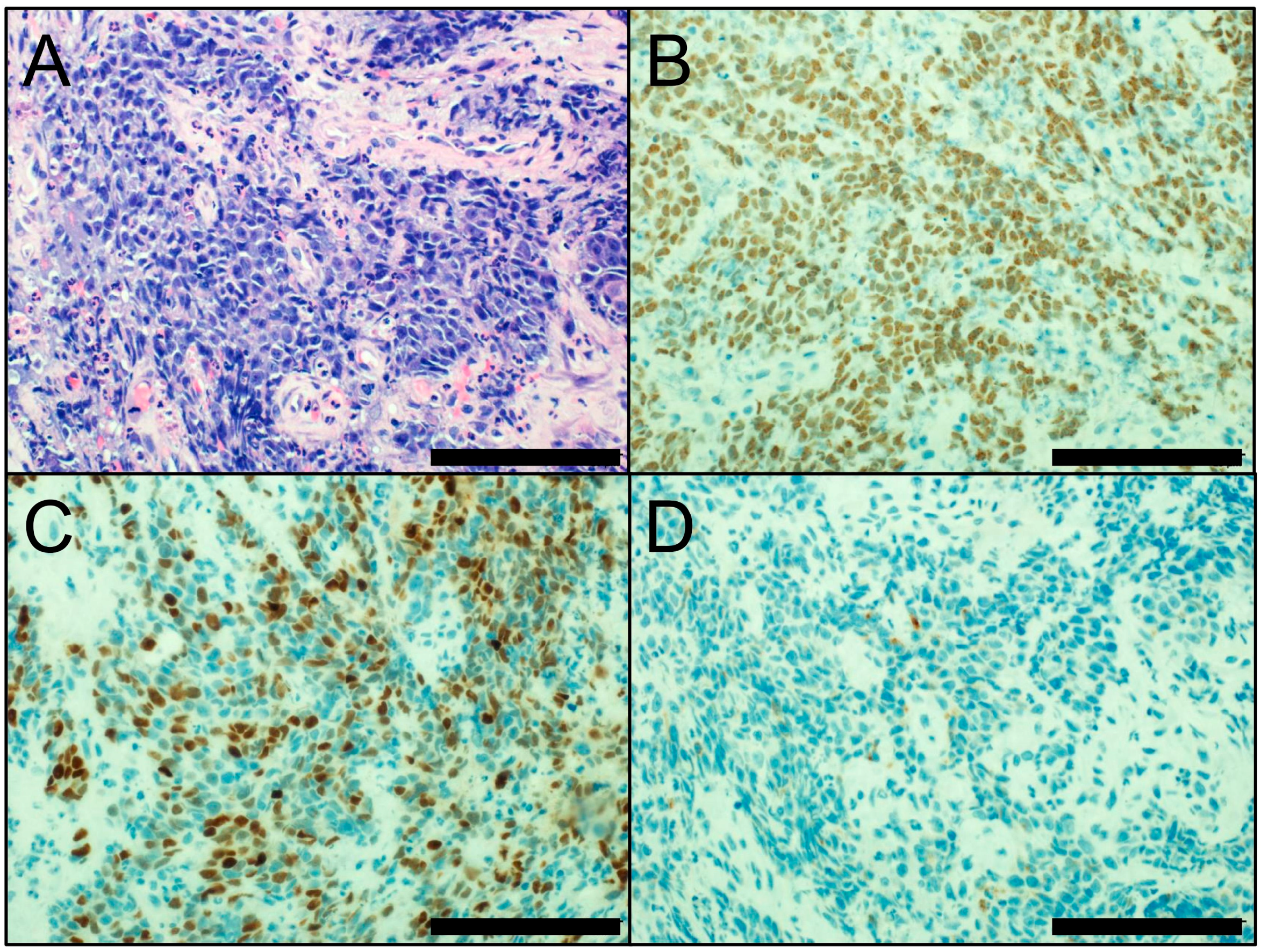 cancers free full text update on immunohistochemistry for the immunohistochemistry