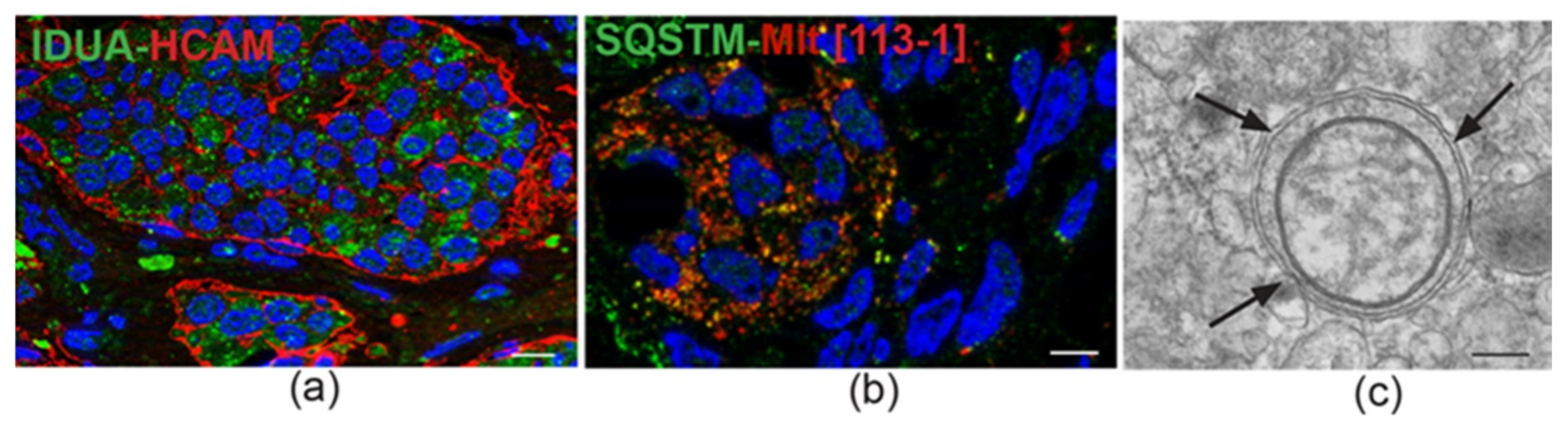 Cancers 11 00273 g002