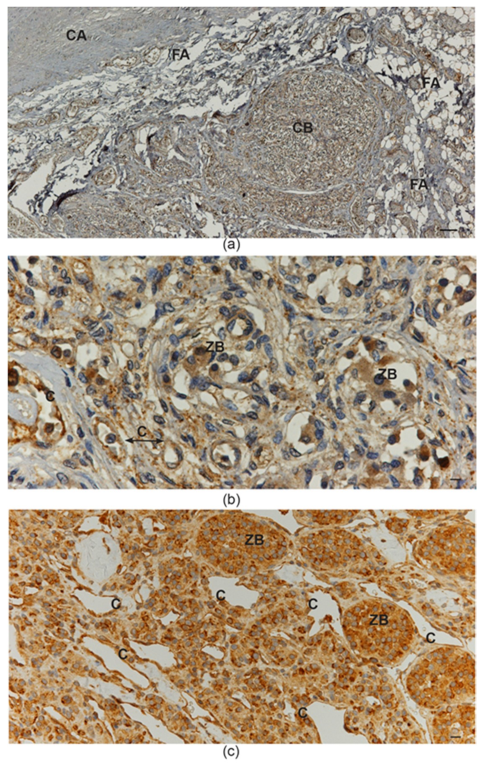 Cancers 11 00273 g004