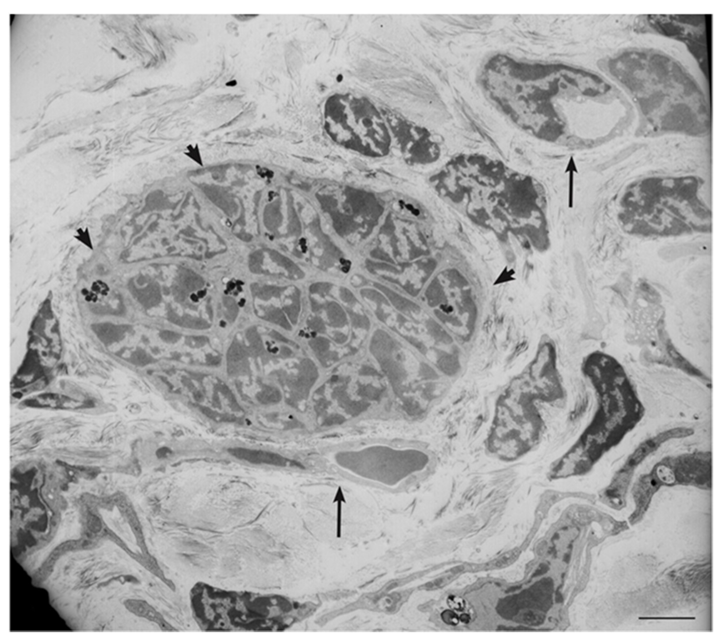 Cancers 11 00273 g006