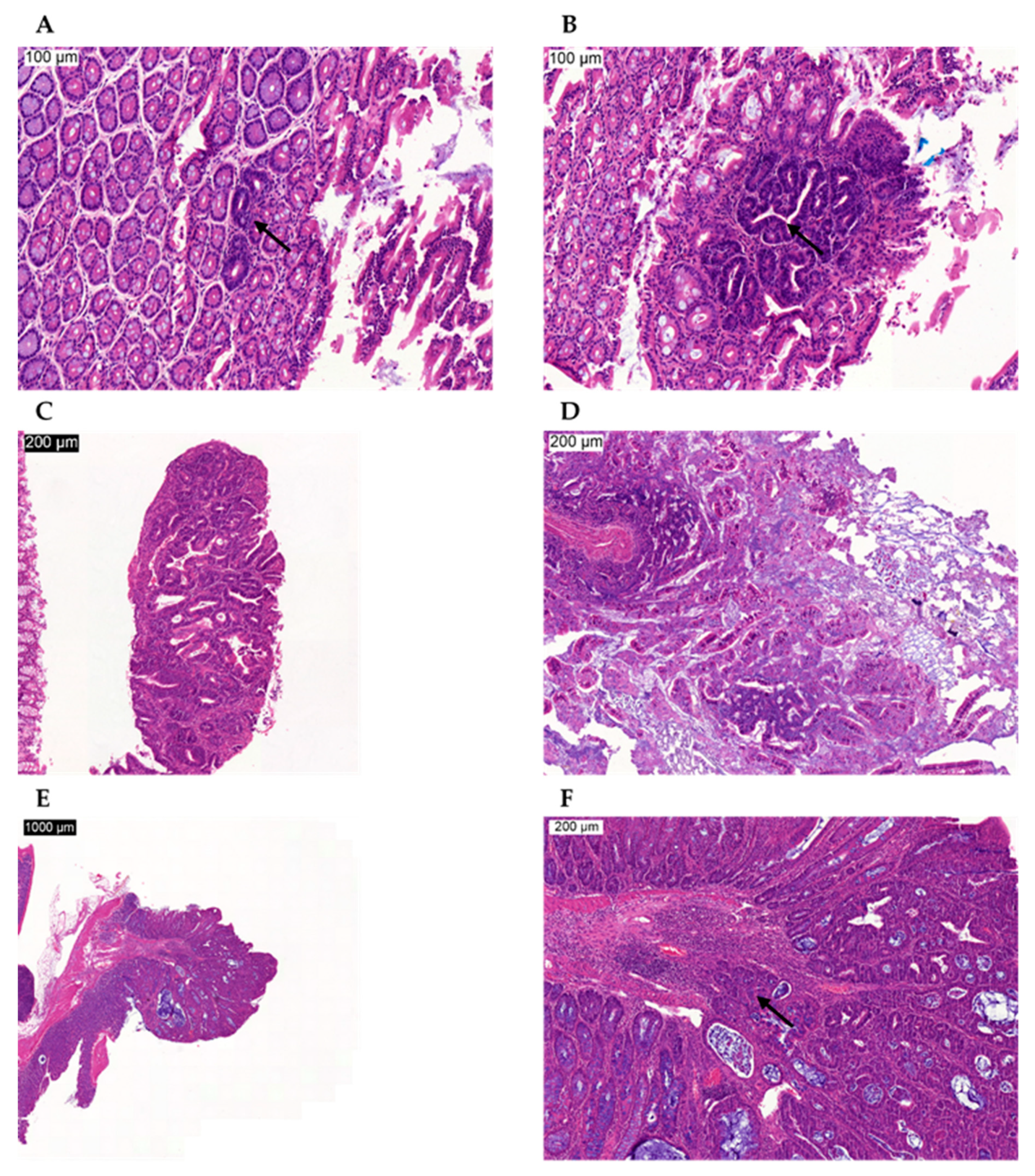 Cancers 11 01214 g004