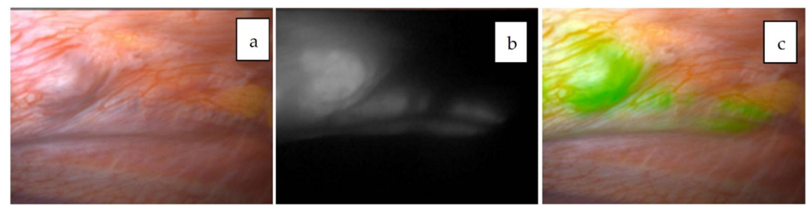 Cancers 11 01215 g007 Cancers 11 01215 g007