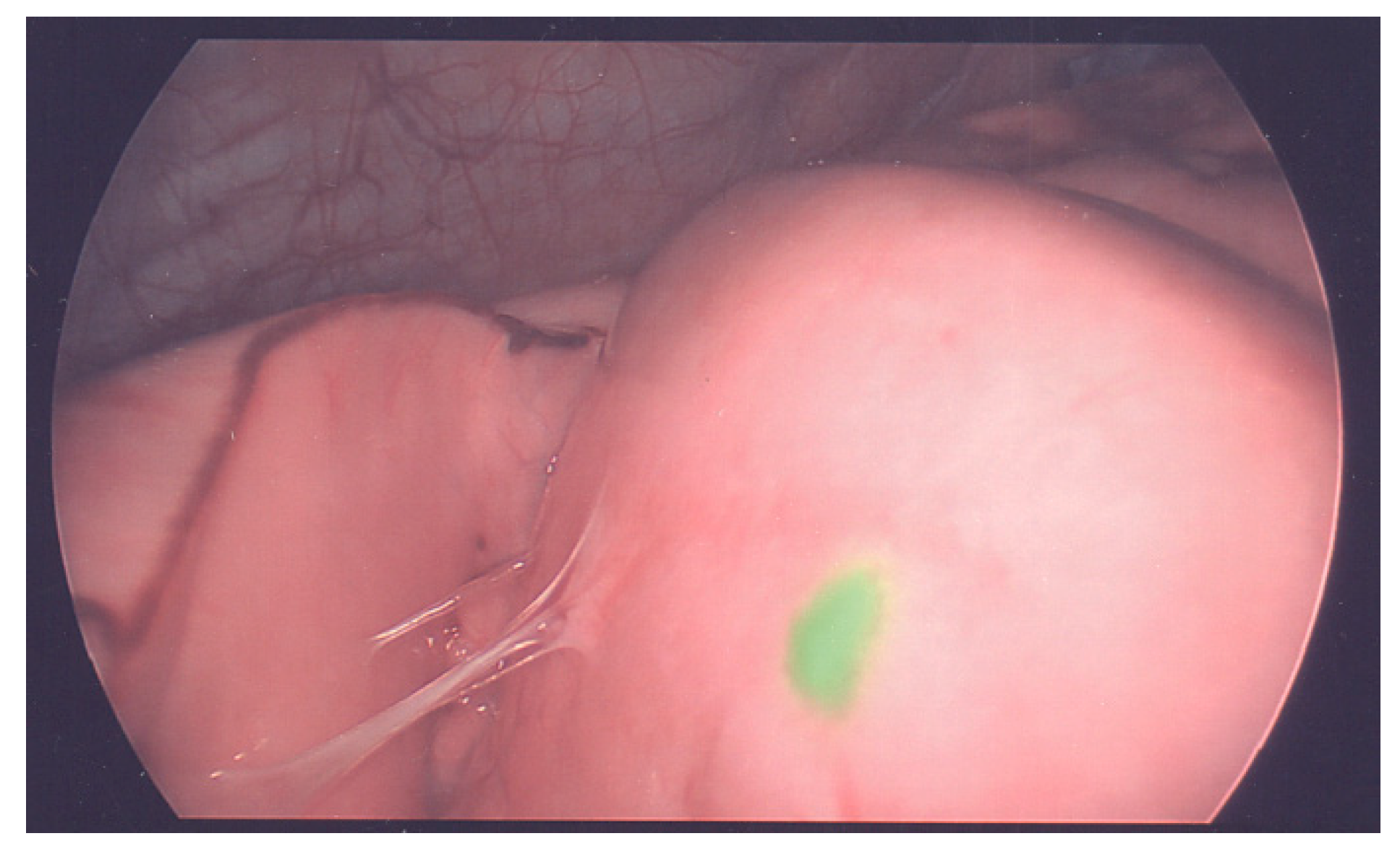 Cancers 11 01944 g002