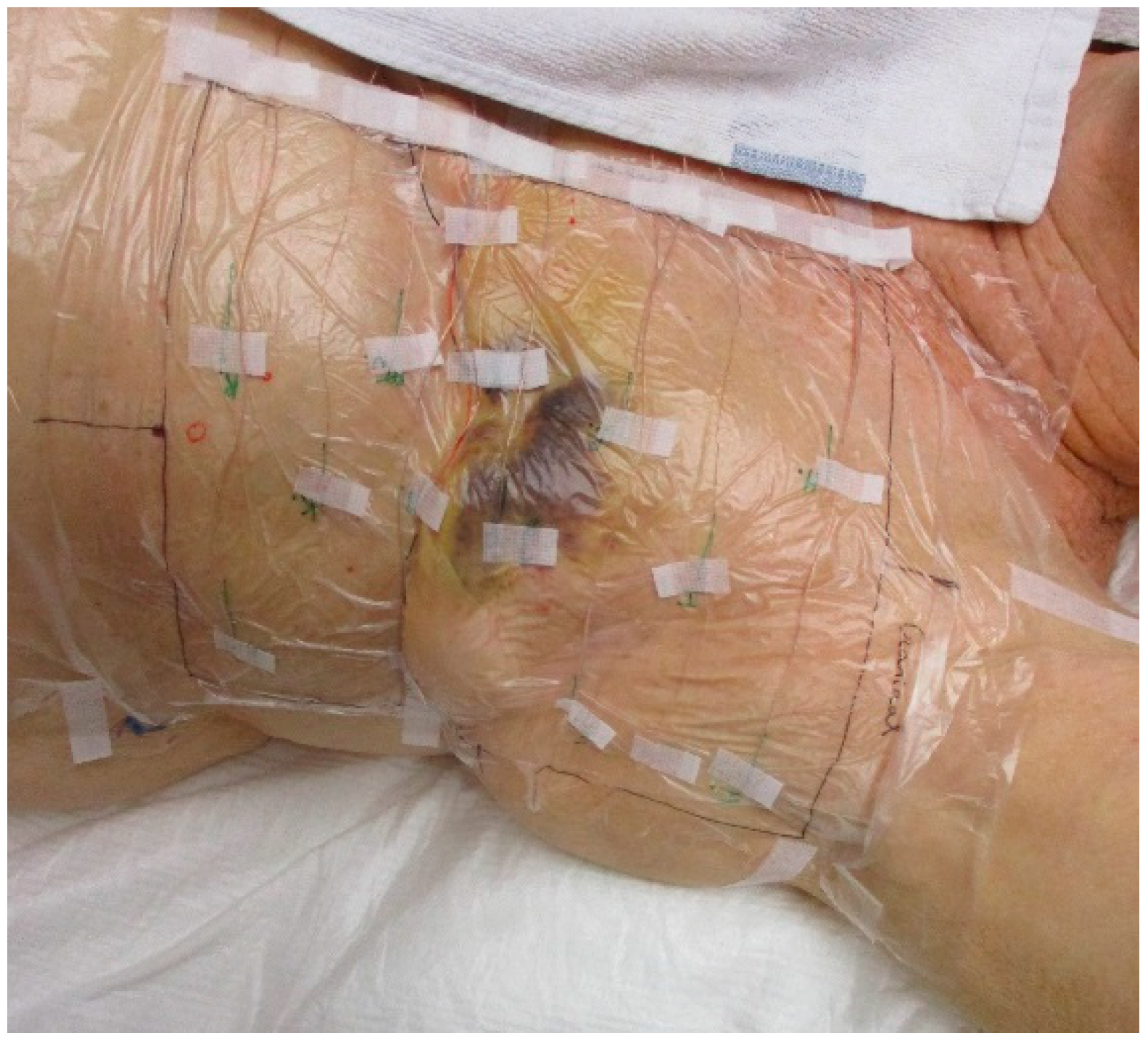 Cancers 12 03644 g001