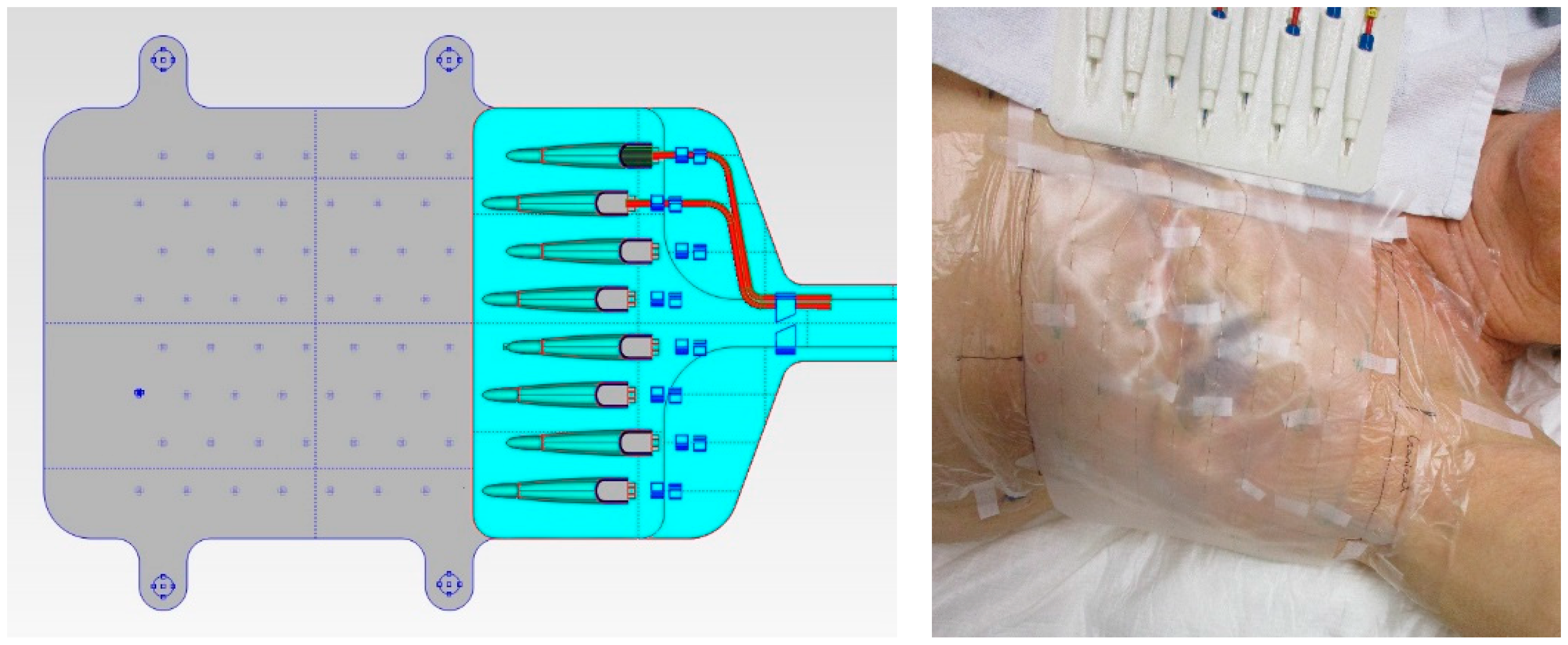 Cancers 12 03644 g002