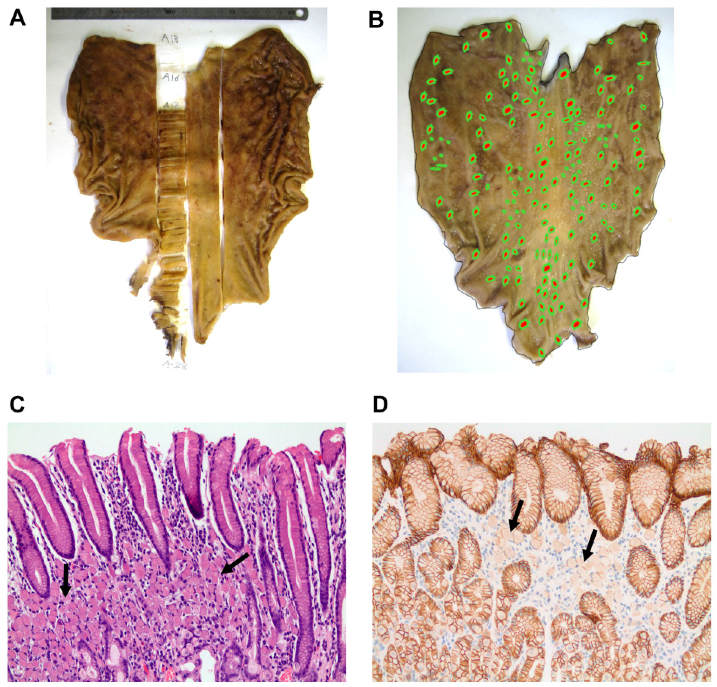 Cancers 13 04359 g002