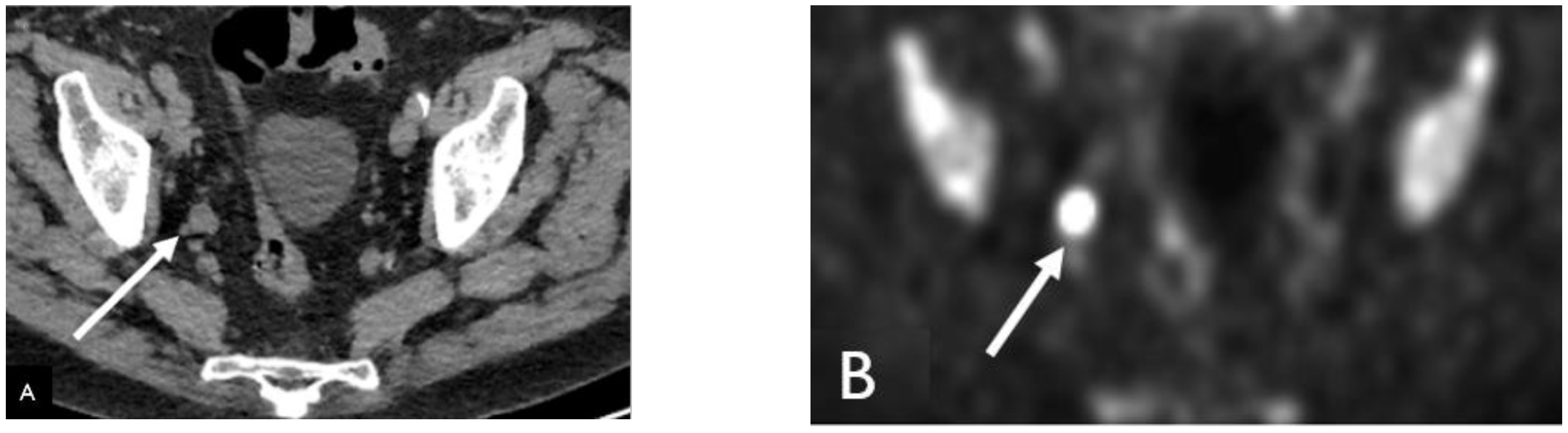 Cancers 15 00796 g001