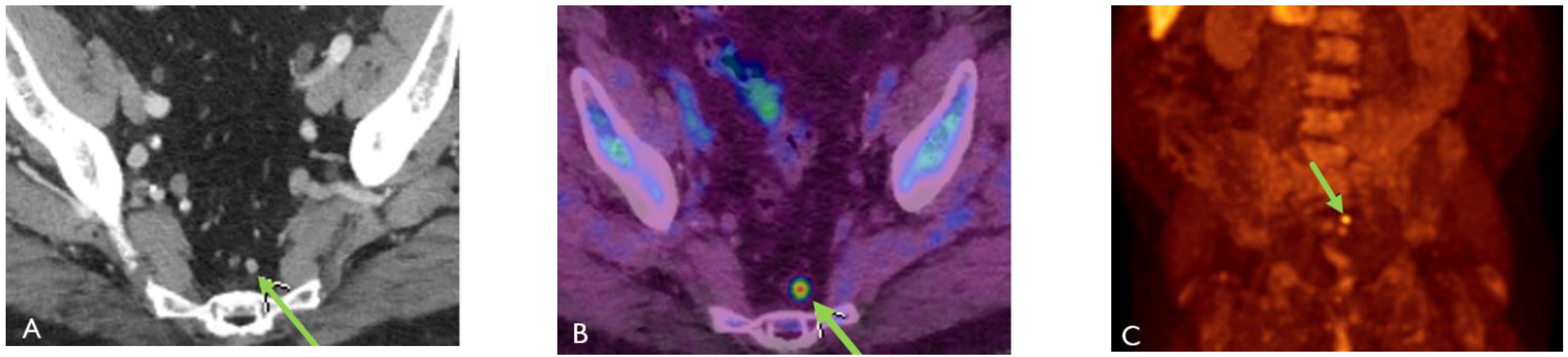 Cancers 15 00796 g003