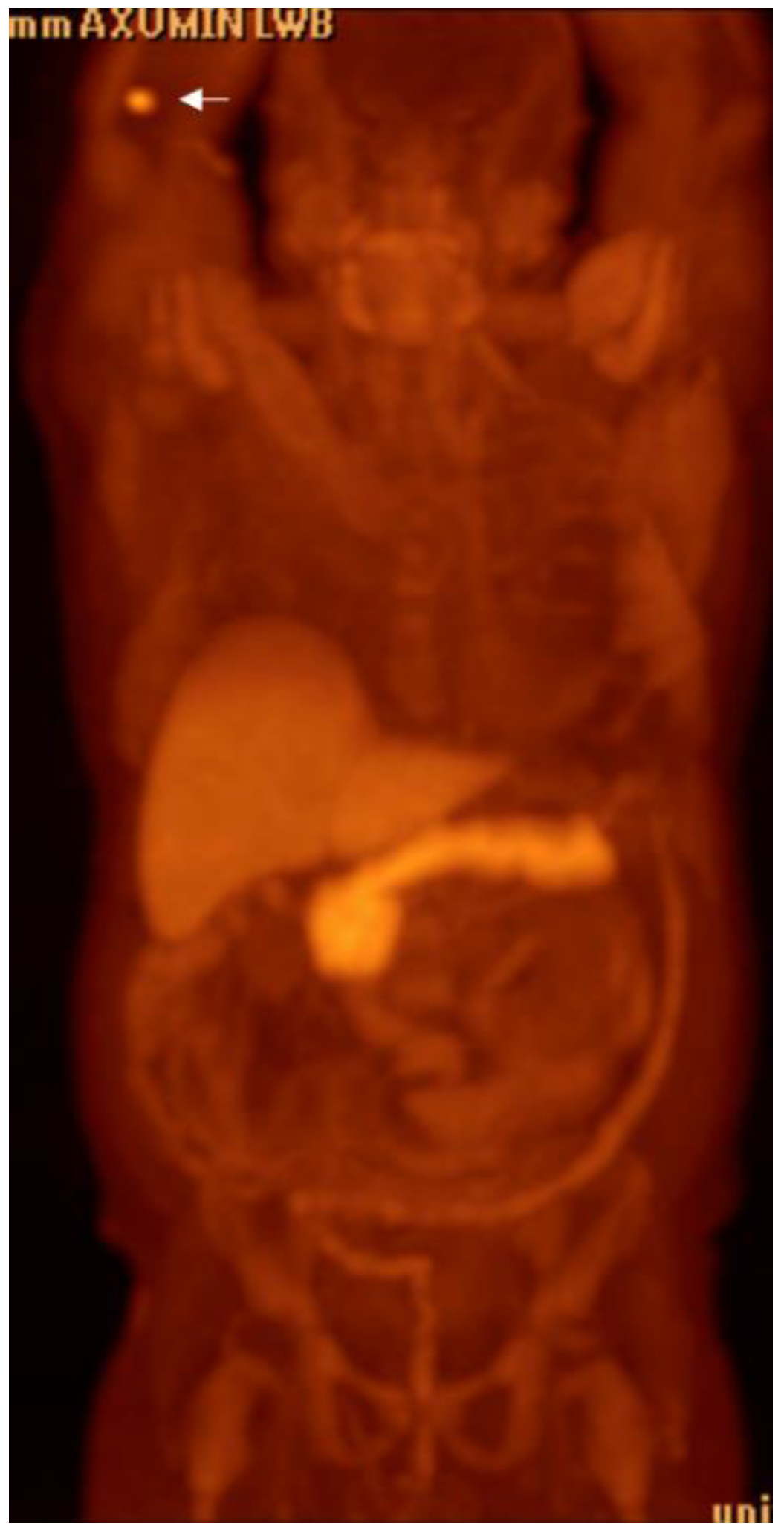 Cancers 15 00796 g004