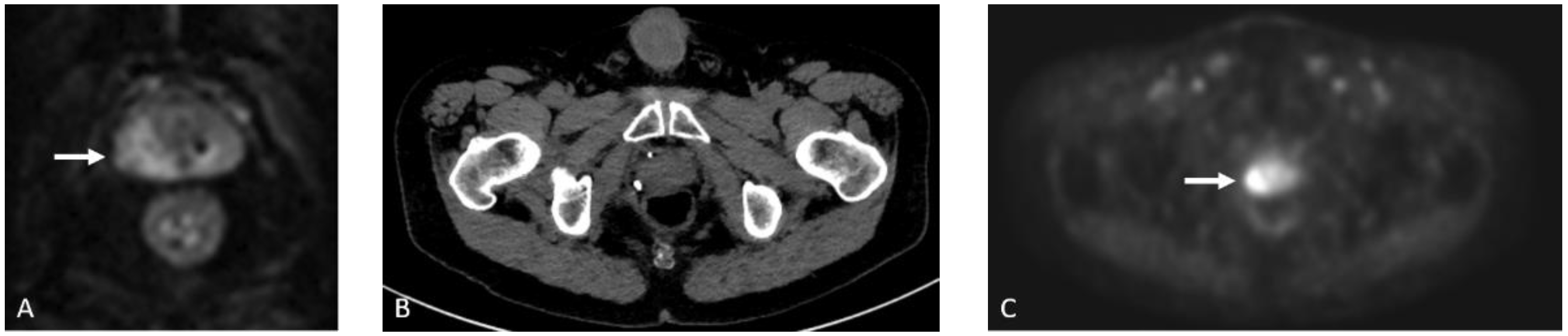 Cancers 15 00796 g005