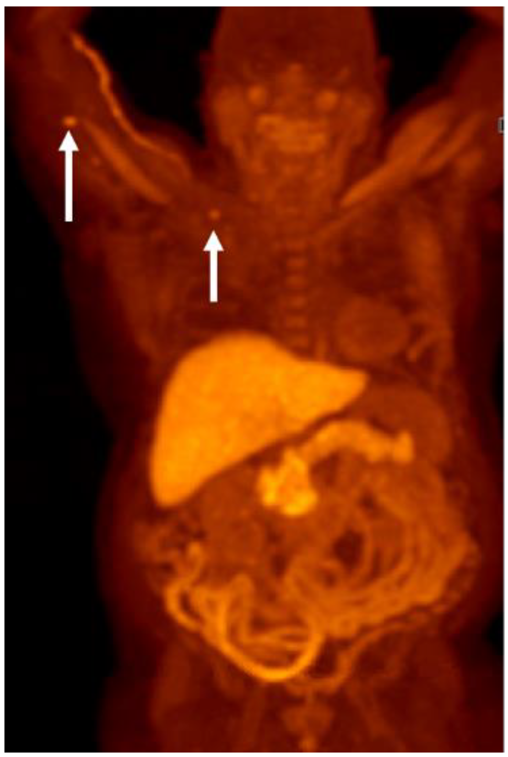 Cancers 15 00796 g008